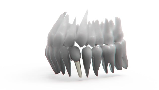 dentist,smile,white teeth