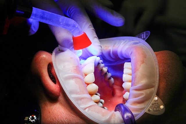 dentist,smile,white teeth