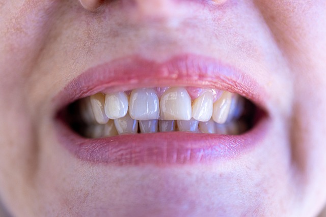 dentist,smile,white teeth