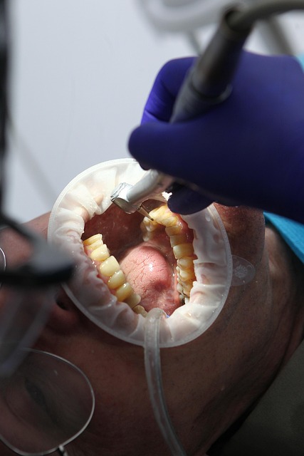 dentist,smile,white teeth