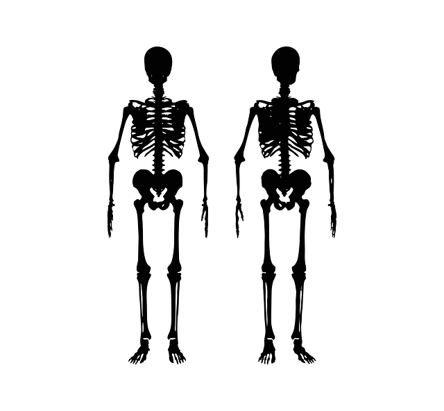 comparison