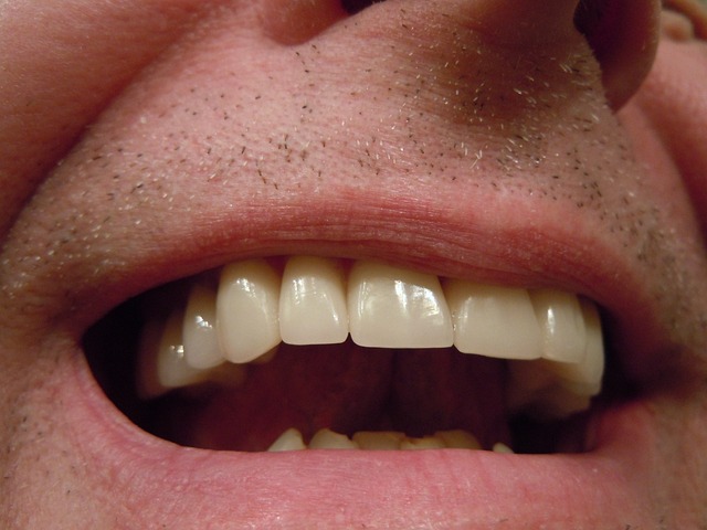 dentist,smile,white teeth