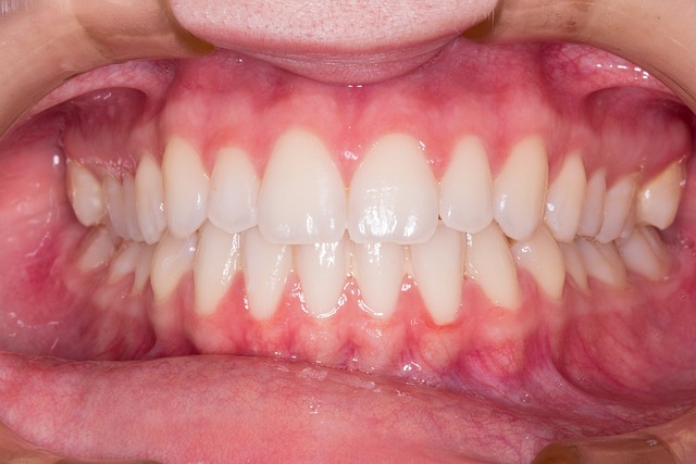 dentist,smile,white teeth