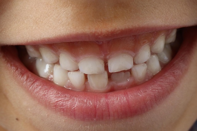 dentist,smile,white teeth