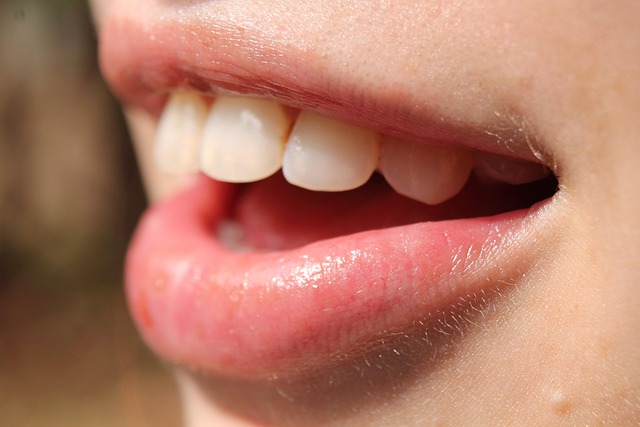 dentist,smile,white teeth