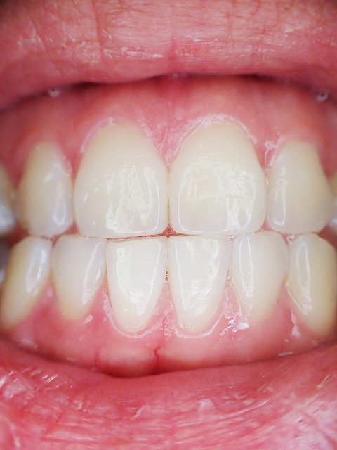 dentist,smile,white teeth