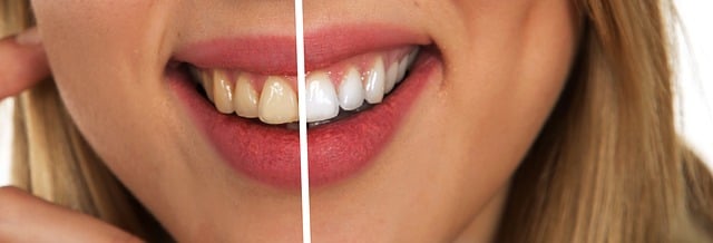 dentistsmilewhite-teeth-640x480-77256246.jpeg