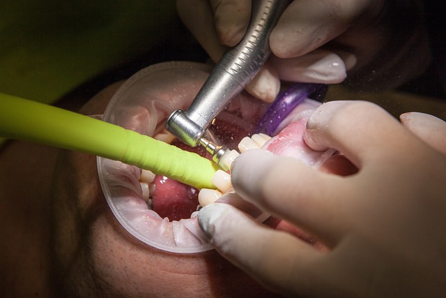 dentist,smile,white teeth