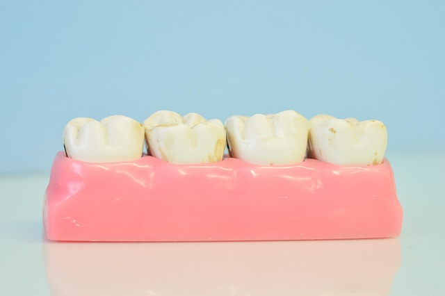 white teeth