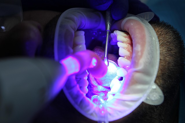 Discover Comprehensive Dental Prosthetics in Eugene, Oregon
