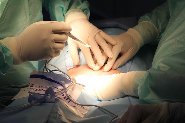 procedures