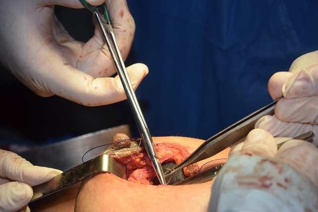 procedures