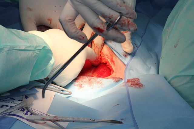 procedures
