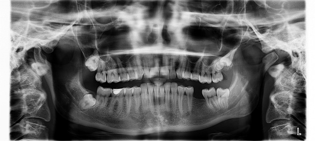 white teeth