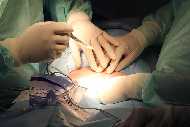 procedures