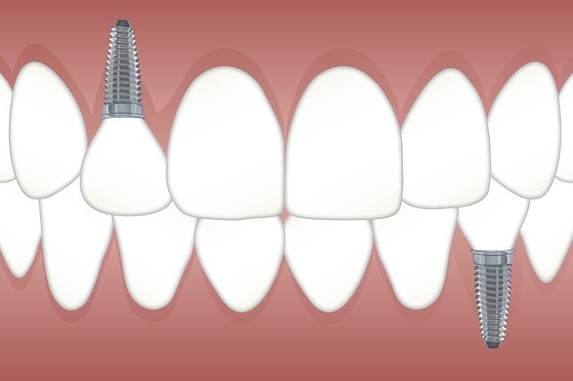 dentist-640x480-58157563.jpeg